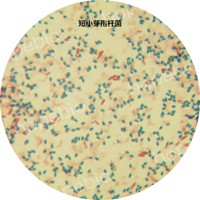 短小芽孢杆菌——芽孢形态 短小芽孢杆菌——芽孢形态