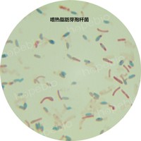 嗜热脂肪芽孢杆菌——芽孢形态 嗜热脂肪芽孢杆菌——芽孢形态