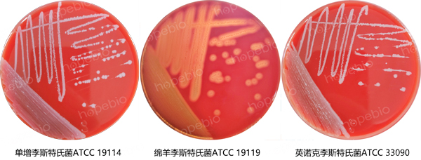 羊血琼脂基础培养基的微生物质控结果