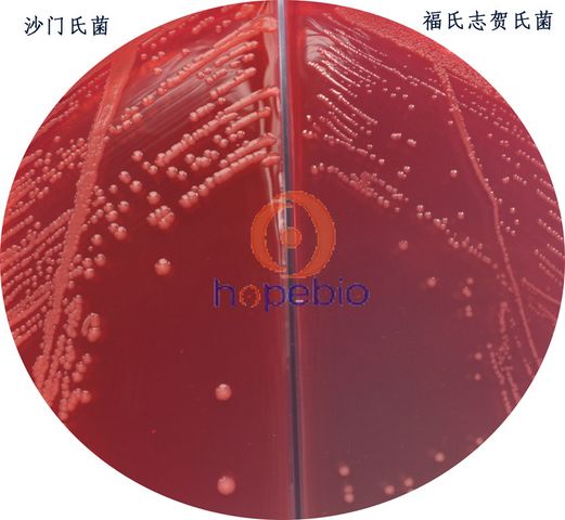 沙门氏、志贺氏