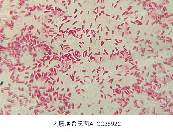 革兰氏染色镜检图——大肠埃希氏菌