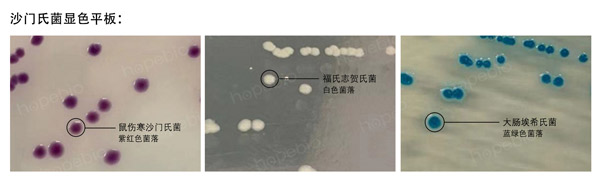 沙门氏菌显色培养基——沙门氏菌、福氏志贺氏菌、大肠埃希氏菌