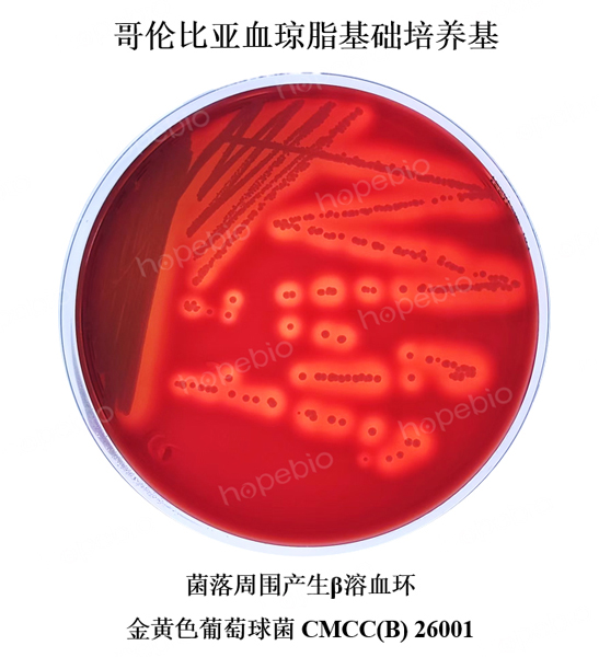 金黄色葡萄球菌CMCC(B)26001在哥伦比亚血琼脂上的菌落状态