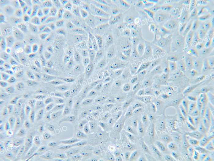 10倍相衬物镜下贴壁生长的VERO细胞状态