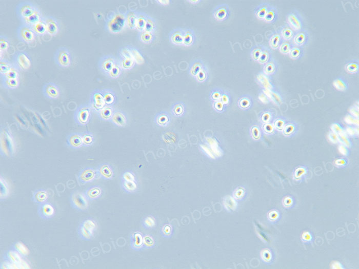 10倍相衬物镜下被0.25%胰蛋白酶消化处理后成流沙状从瓶底滑落的VERO细胞