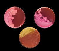 甘露醇卵黄多粘菌素琼脂（MYP）