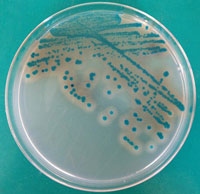蜡样芽孢杆菌显色(第三代)