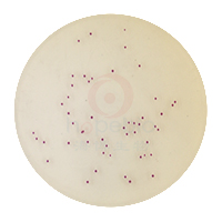 弗氏柠檬酸盐杆菌-茜素-β-半乳糖苷琼脂