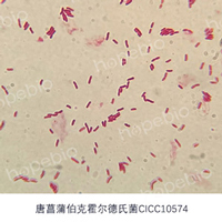 革兰氏染色镜检图——唐菖蒲伯克霍尔德氏菌/