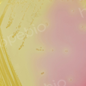 不同背景下金黄色葡萄球菌在甘露醇高盐琼脂上的状态