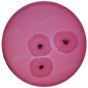 质控菌株在纤维素刚果红培养基上的生长情况