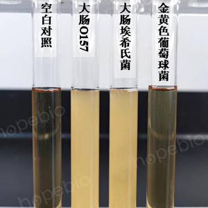 不同质控菌株在改良胰蛋白胨大豆液体培养基(mTSB)的生长状态