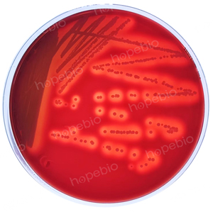 金黄色葡萄球菌CMCC(B)26001在哥伦比亚血琼脂上的菌落状态